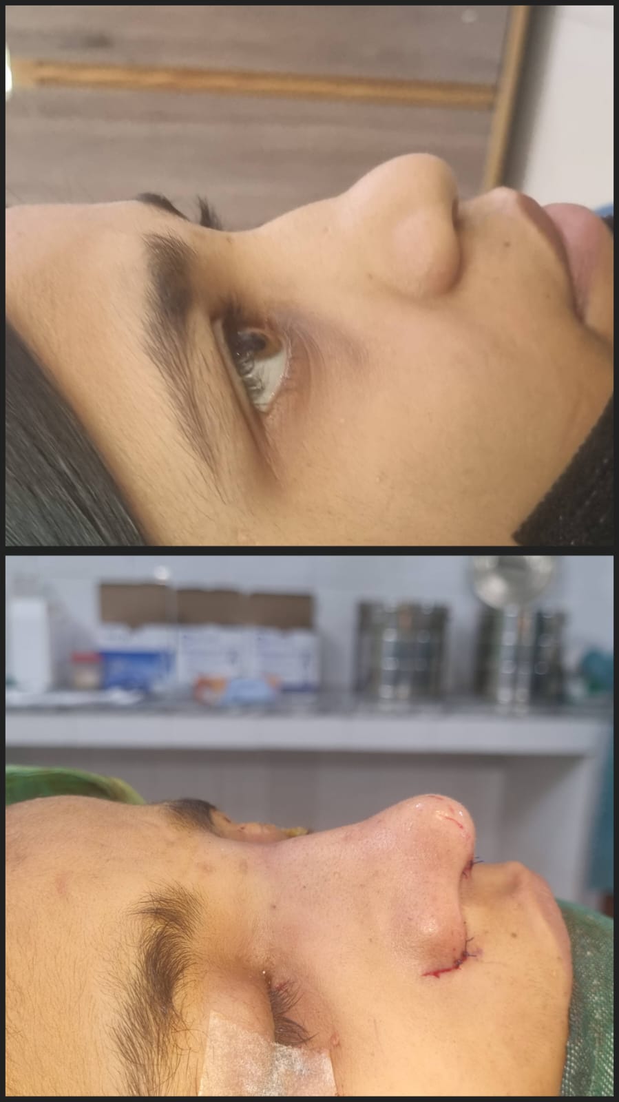 Before & After 1